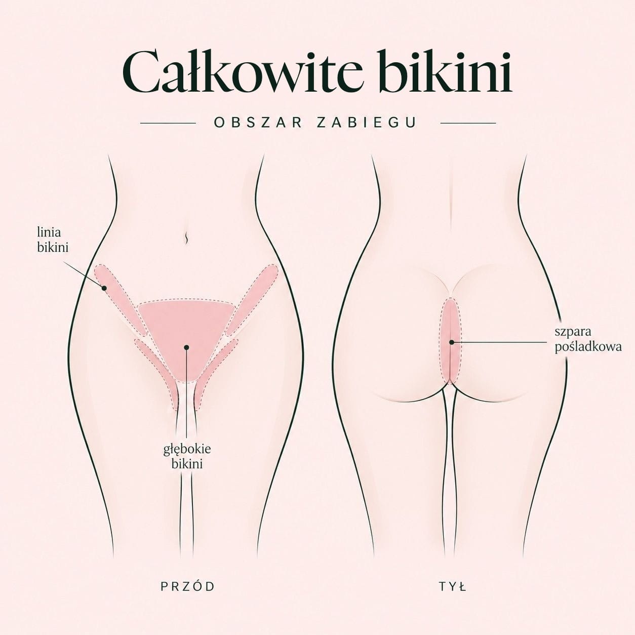 Schemat zabiegu: całkowite bikini — obszar zabiegu z przodu i z tyłu