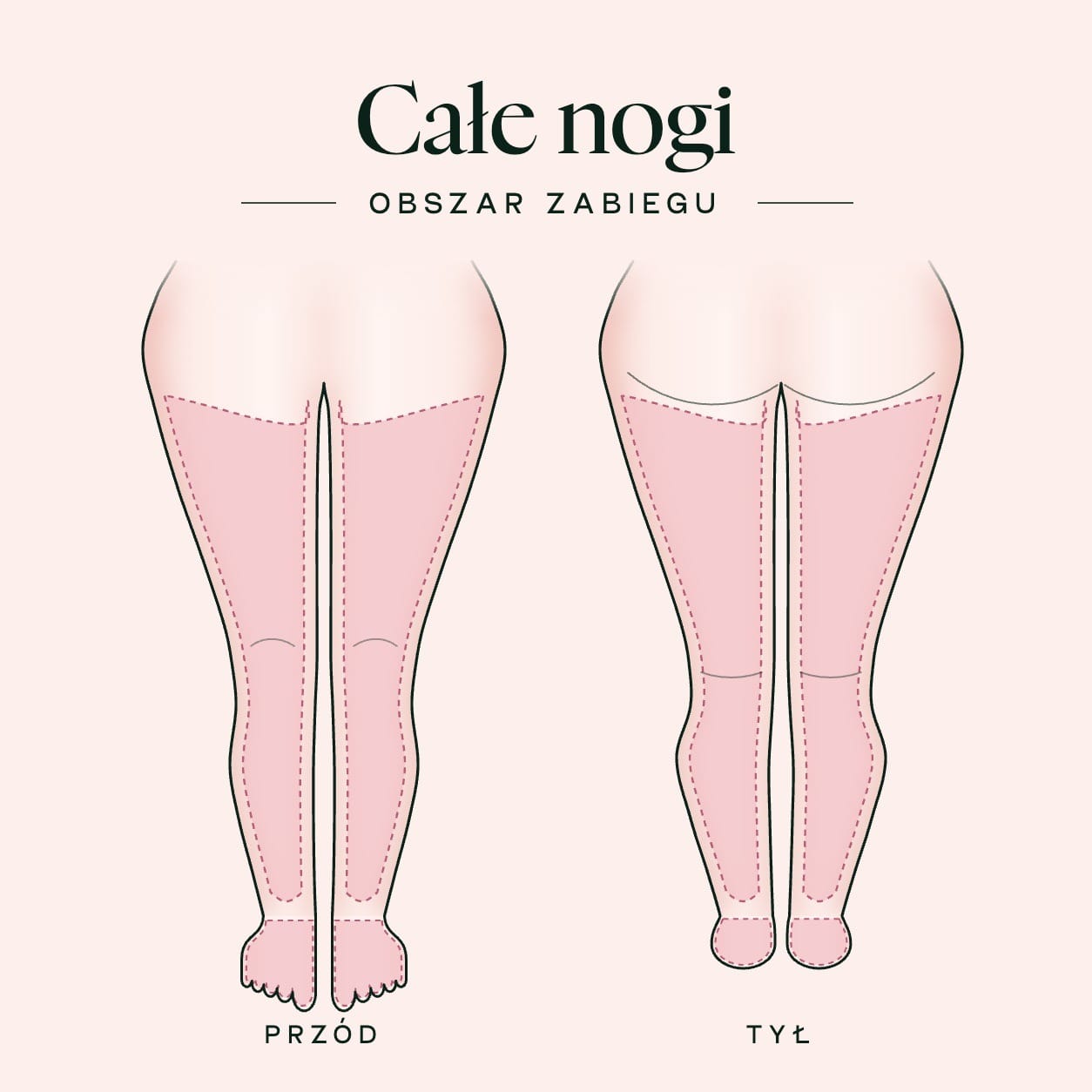Schemat zabiegu: całe nogi wraz ze stopami i palcami — obszar zabiegu z przodu i z tyłu